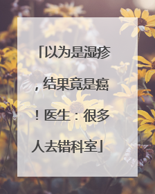 以为是湿疹，结果竟是癌！医生：很多人去错科室